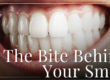 Big smile with bright white teeth